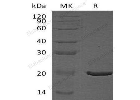 Recombinant Human CRYAA Protein (His Tag)