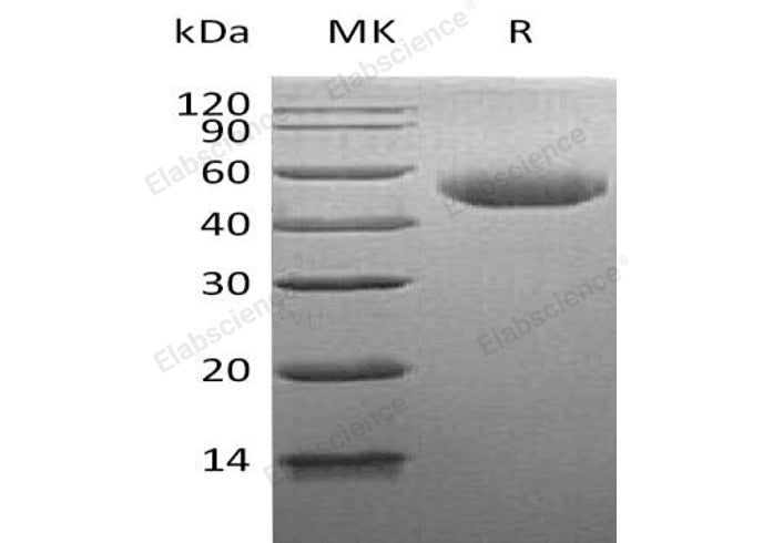 Recombinant Human Alpha-Galactosidase A/GLA Protein (His Tag)