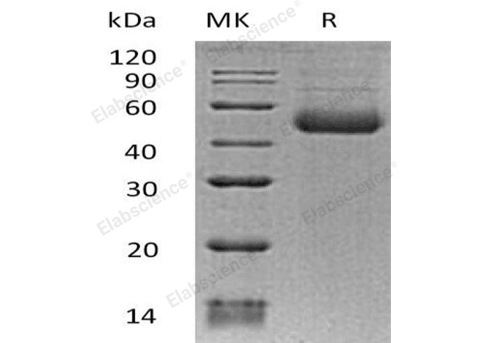 Recombinant Human ST8SIA1 Protein (His Tag)