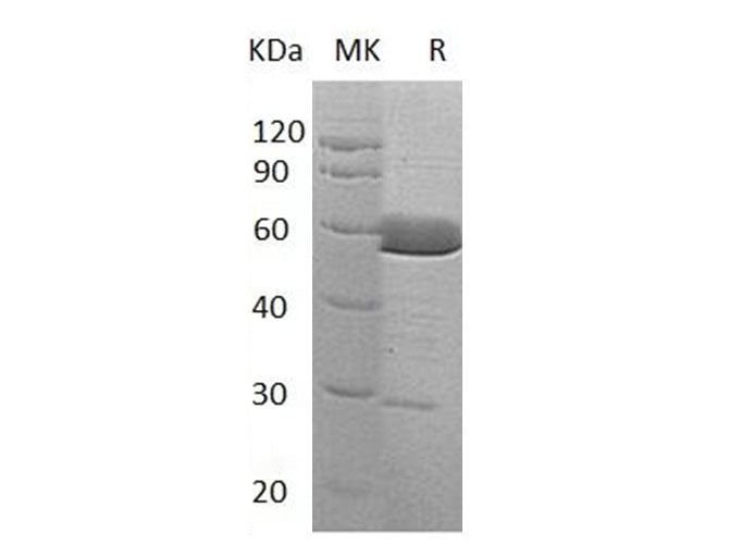 Recombinant Human Alpha-Parvin/PARVA Protein (His Tag)