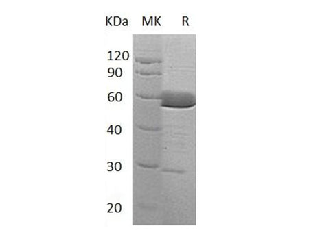 Recombinant Human Alpha-Parvin/PARVA Protein (His Tag)