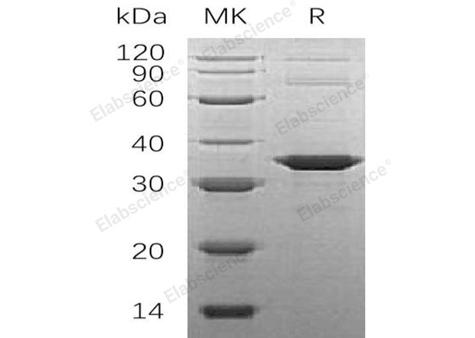 Recombinant Human SNAP-alpha/NAPA Protein (His Tag)