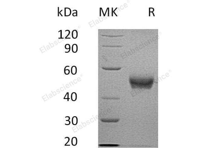 Recombinant Human B4GALT3 Protein (His Tag)
