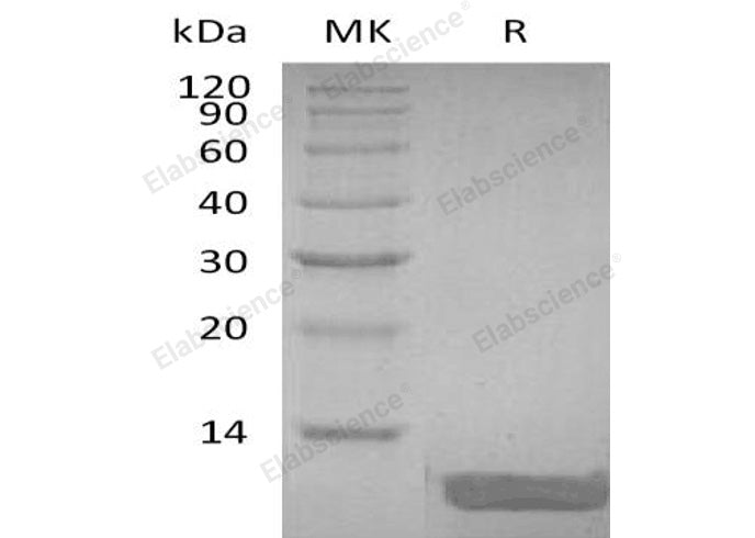 Recombinant Human DEFB104A Protein