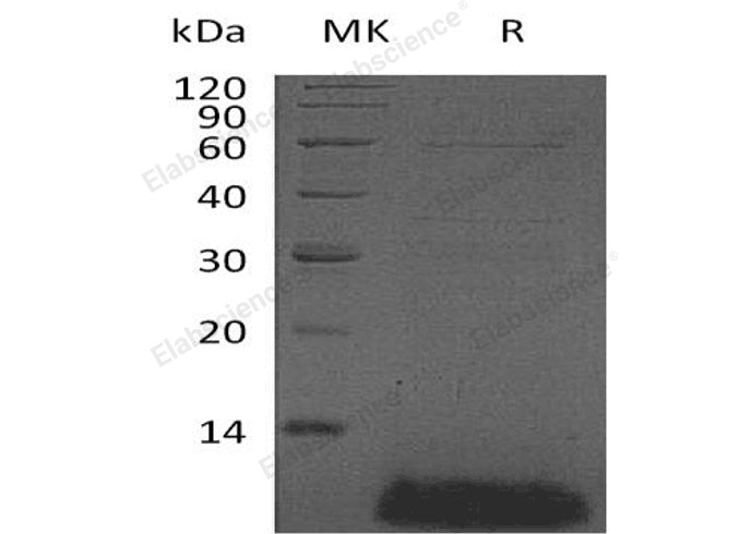 Recombinant Human β-Defensin 4A/DEFB4A Protein