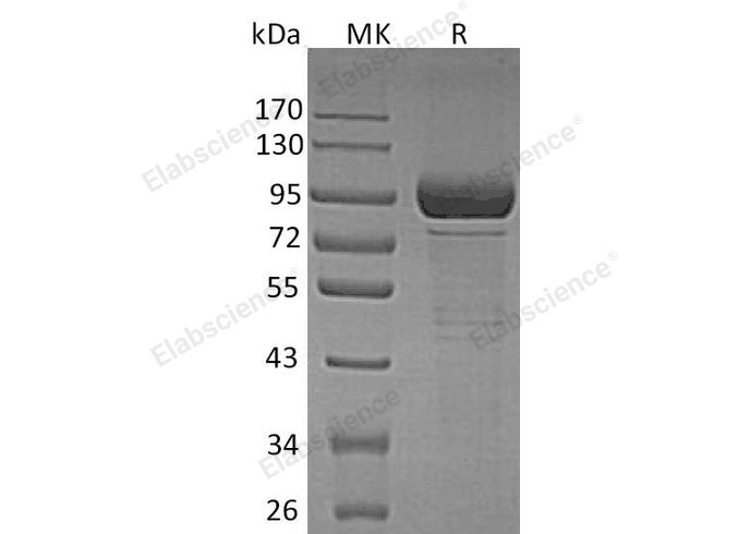 Recombinant Human β-Galactosidase/GLB1 Protein (His Tag)