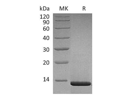 Recombinant Human β-NGF/NGFB Protein (aa 122-23, Human Cells)(Active)