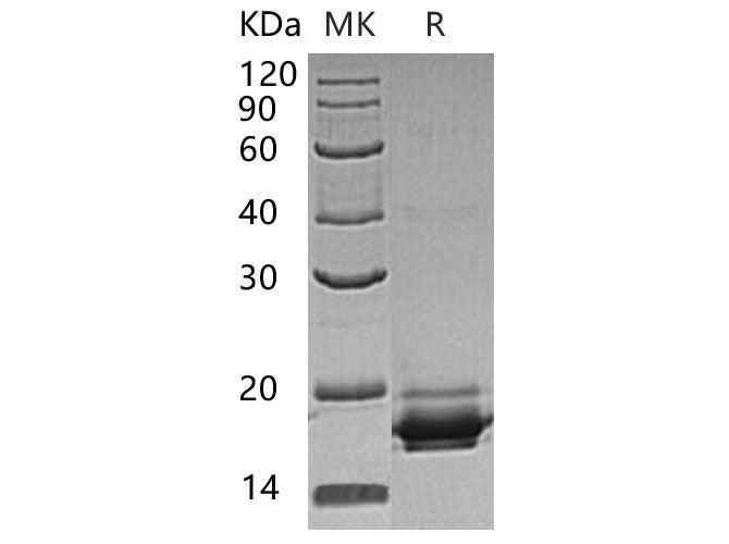 Recombinant Human GGACT Protein (His Tag)