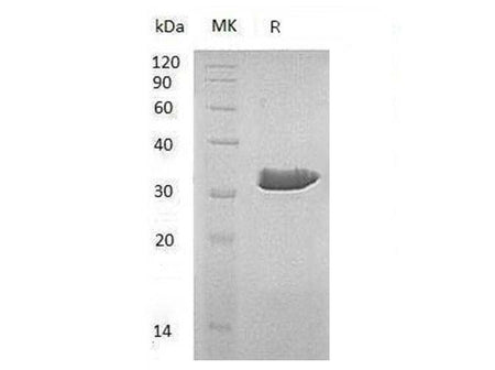Recombinant Human ECH1 Protein
