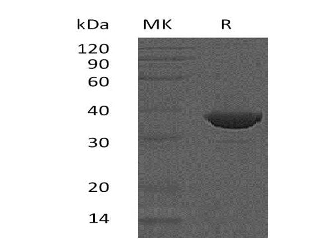 Recombinant Human FBPase 1/FBP1 Protein (Human Cells, His Tag)