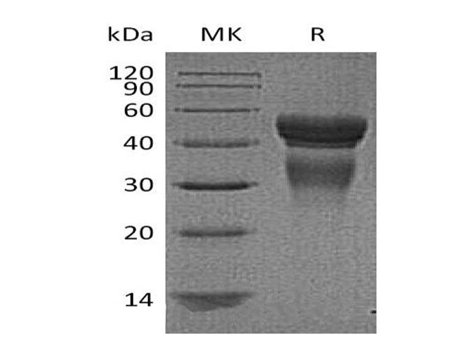 Recombinant Human Interleukin-12/IL-12 Protein (Active)