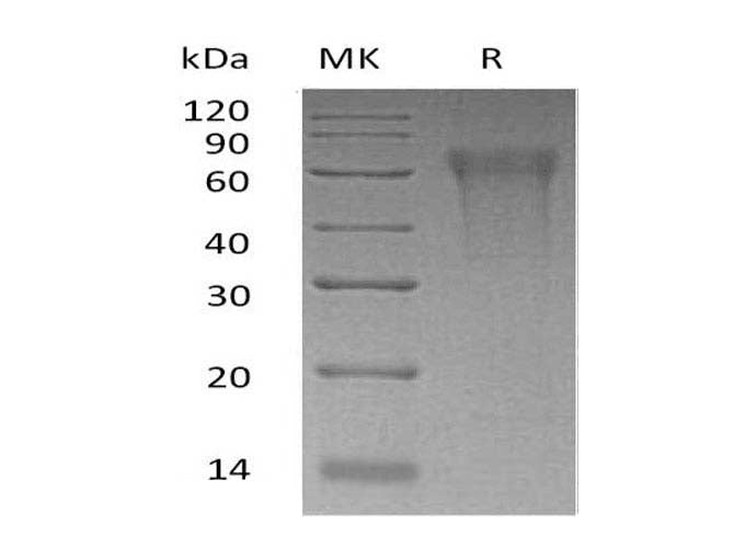 Recombinant Human CLM-9/TREM4 Protein (His Tag)