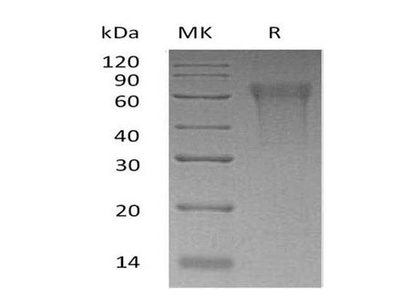 Recombinant Human CLM-9/TREM4 Protein (His Tag)