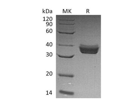 Recombinant Human ERP27 Protein (His Tag)