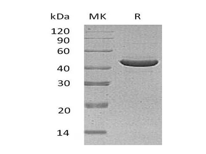 Recombinant Human SerpinB3/SCCA1 Protein (Human Cells, His Tag)