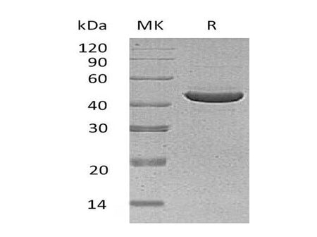 Recombinant Human SerpinB3/SCCA1 Protein (Human Cells, His Tag)