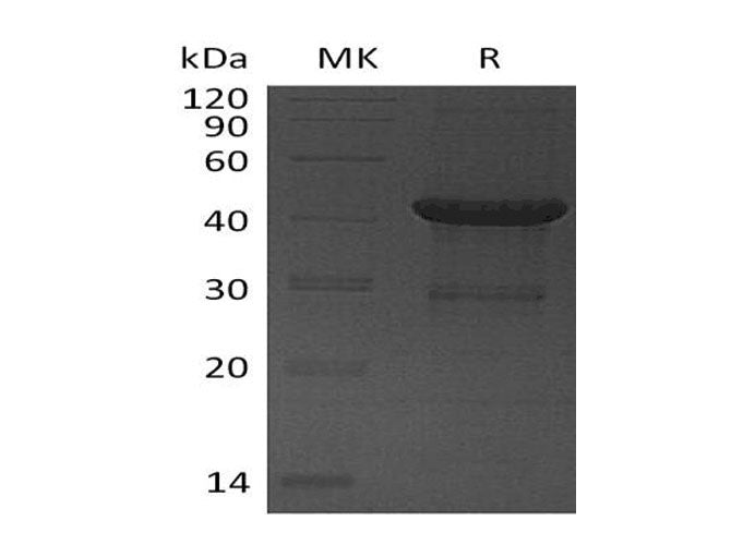 Recombinant Human UBE2D4 Protein (GST Tag)