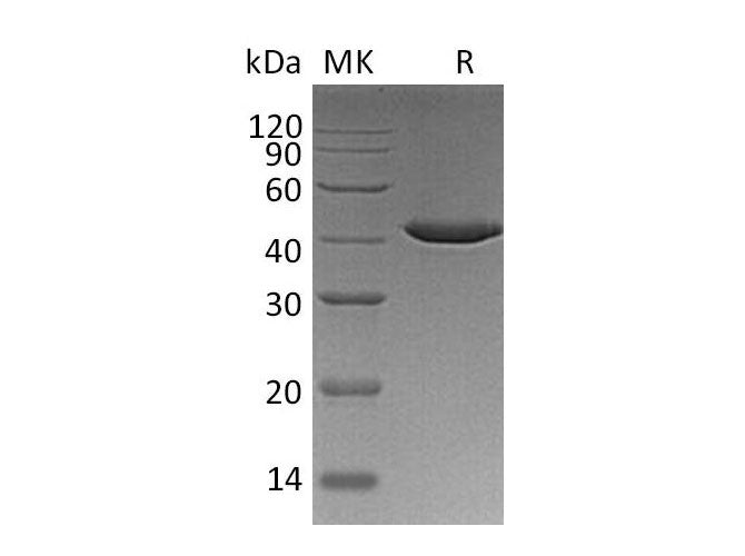 Recombinant Human SERPINB9/PI-9 Protein (Human Cells, His Tag)