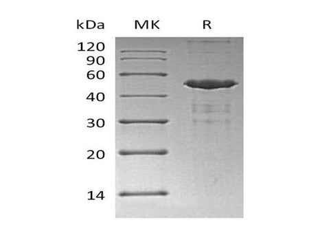 Recombinant Human UBE2A Protein (GST & His Tag)