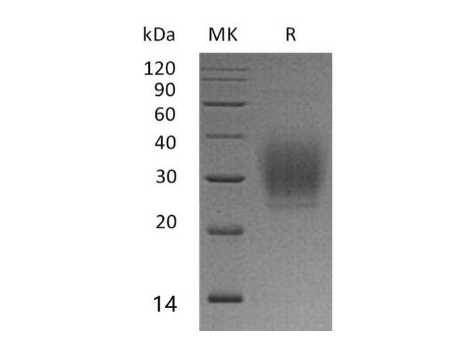 Recombinant Human PTH1R Protein (His Tag)