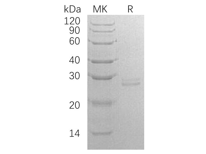 Recombinant Human RPE Protein (E.coli, His Tag)