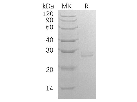 Recombinant Human RPE Protein (E.coli, His Tag)