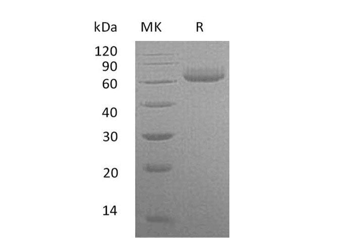 Recombinant Human VNN2 Protein (His Tag)