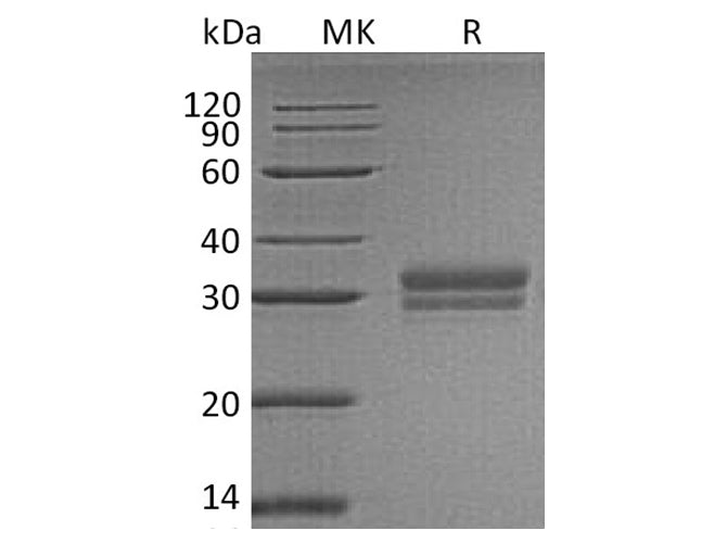 Recombinant Human VSIG2 Protein (His Tag)