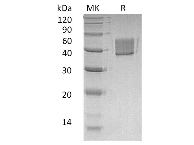 Recombinant Human FCRL1 Protein (His Tag)