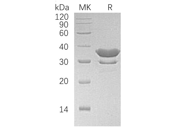 Recombinant Human SULT2A1 Protein (His Tag)