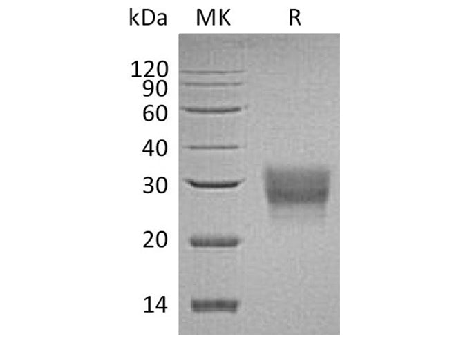 Recombinant Human CD8 beta/CD8B Protein (His Tag)