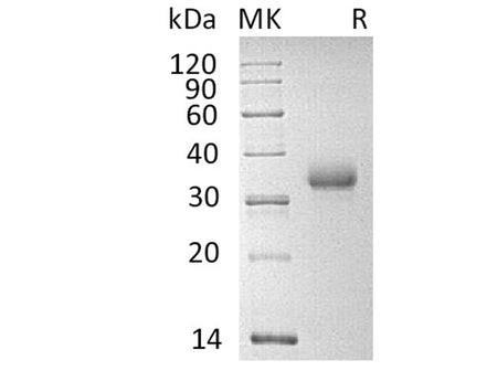 Recombinant Human CD2 Protein (His Tag)