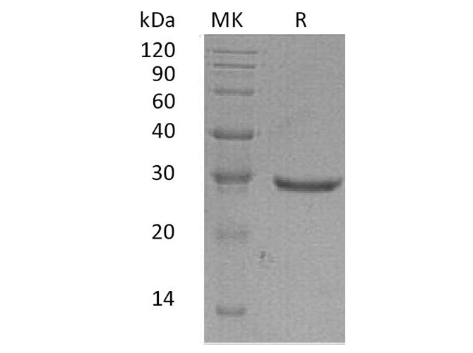 Recombinant Human GLIPR1 Protein (His Tag)