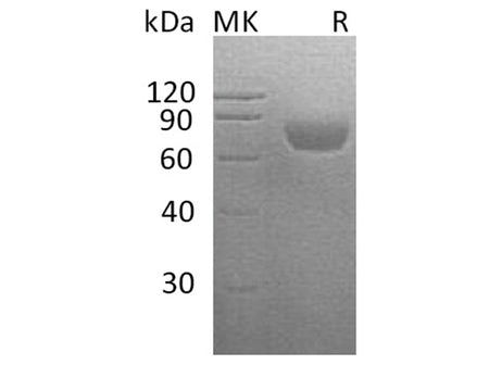 Recombinant Human CD48 Protein (His Tag)