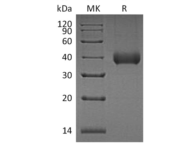 Recombinant Human Kallikrein 11/KLK11 Protein (His Tag)