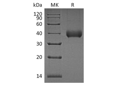 Recombinant Human Kallikrein 11/KLK11 Protein (His Tag)