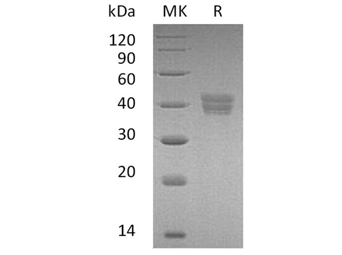 Recombinant Human HtrA2/Omi Protein (His Tag)