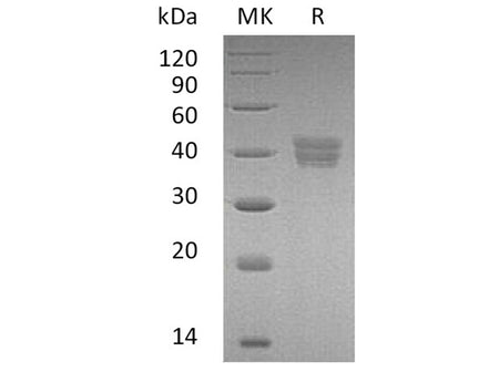 Recombinant Human HtrA2/Omi Protein (His Tag)