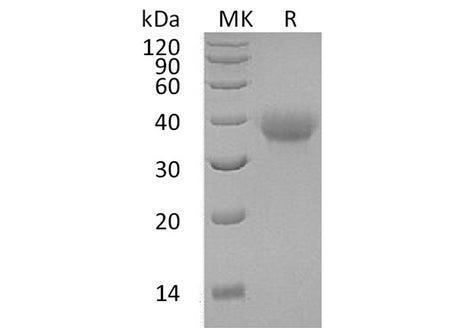 Recombinant Human OX40/TNFRSF4 Protein (His Tag)(Active)
