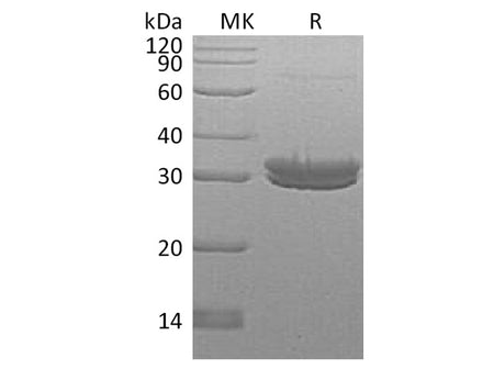 Recombinant Human Kallikrein 7/KLK7 Protein (His Tag)
