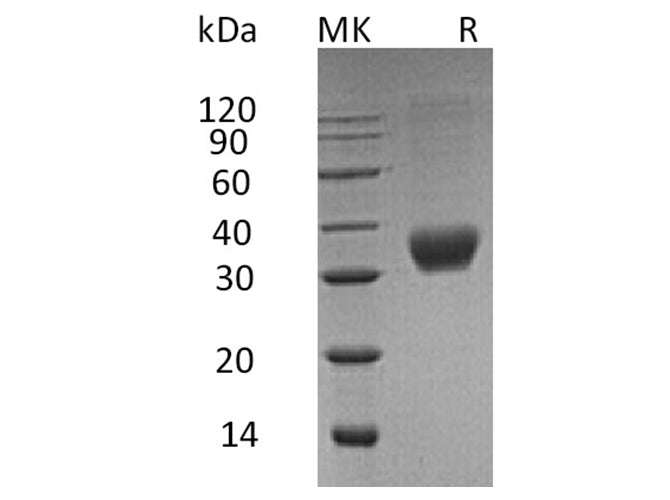 Recombinant Human Fas/CD95/TNFRSF6 Protein (His Tag)
