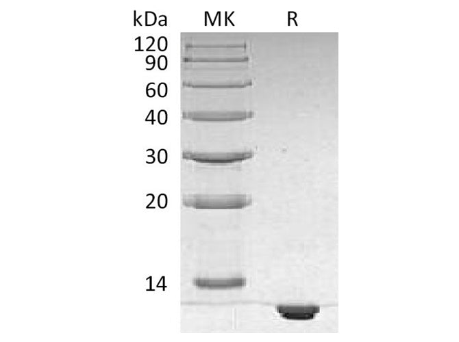 Recombinant Human S100B Protein (His Tag)