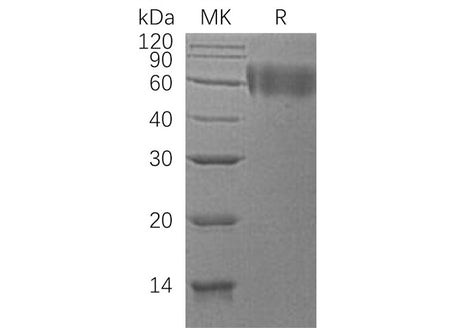 Recombinant Human DR6/TNFRSF21 Protein (His Tag)