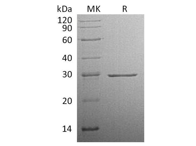 Recombinant Human Factor D Protein (His Tag)