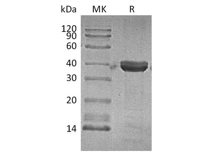 Recombinant Human Cathepsin Z Protein (His Tag)