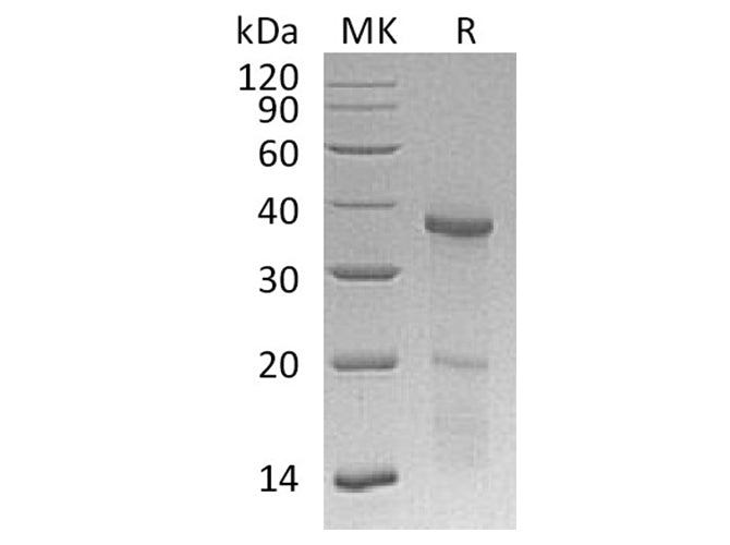 Recombinant Human HOXB4 Protein (His Tag) 
