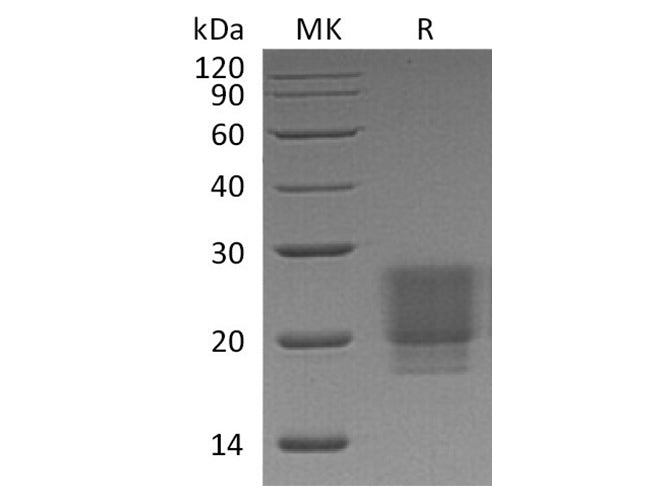 Recombinant Human/Mouse/Rat Irisin/FNDC5 Protein (His Tag)