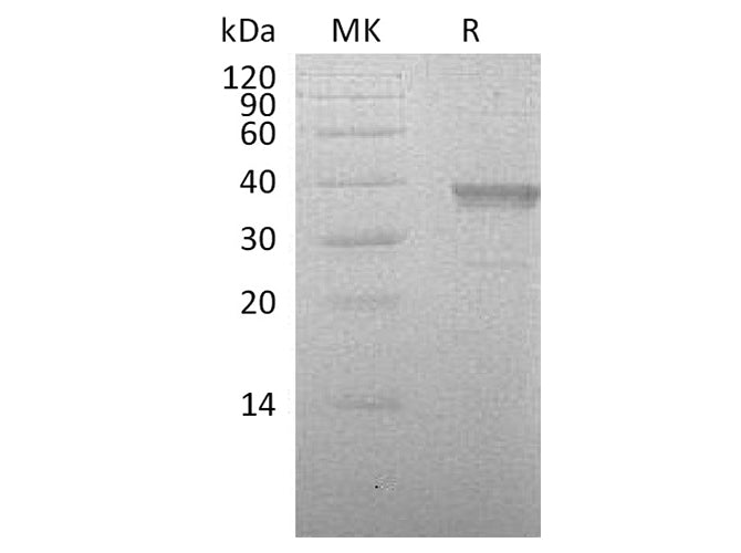 Recombinant Human HABP2 Protein (His Tag)
