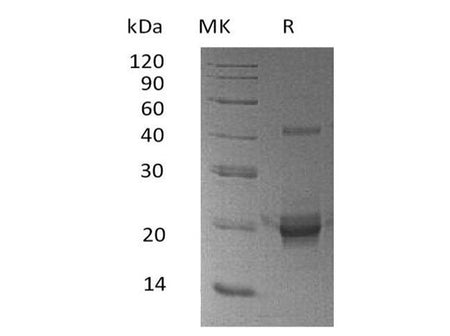 Recombinant Human DUSP3/VHR Protein (His Tag)