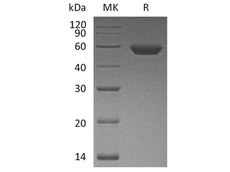 Recombinant Human ROR2 Protein (His Tag)